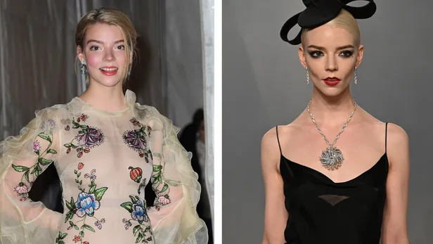 Celebrities en buccal fat removal before en after: Anya-Taylor Joy.