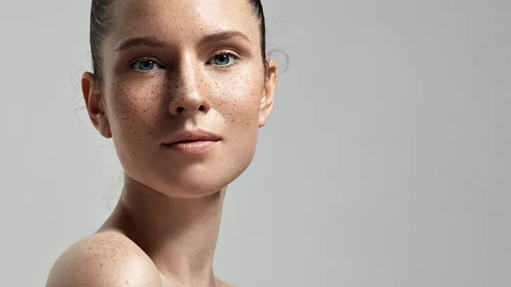 Trend: sproeten laten tatoeëren